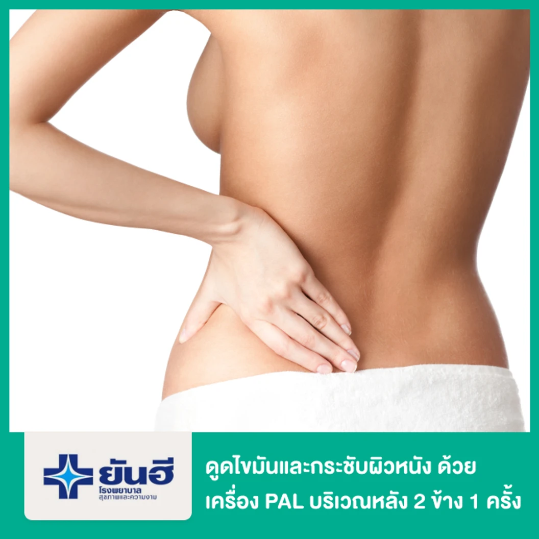 โปรแกรมดูดไขมันและกระชับผิวหนัง ด้วยเครื่อง PAL และ Renuvion บริเวณหลัง 2 ข้าง 1 ครั้ง