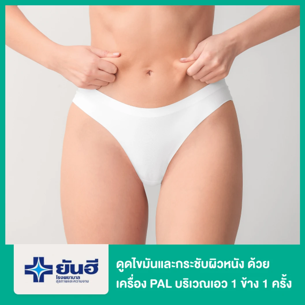 โปรแกรมดูดไขมันและกระชับผิวหนัง ด้วยเครื่อง PAL และ Renuvion บริเวณเอว 1 ข้าง 1 ครั้ง