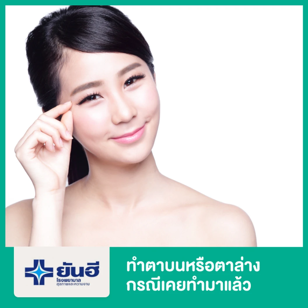 แก้ไขตาบนหรือตาล่าง กรณีเคยทำมาแล้วจากที่อื่น