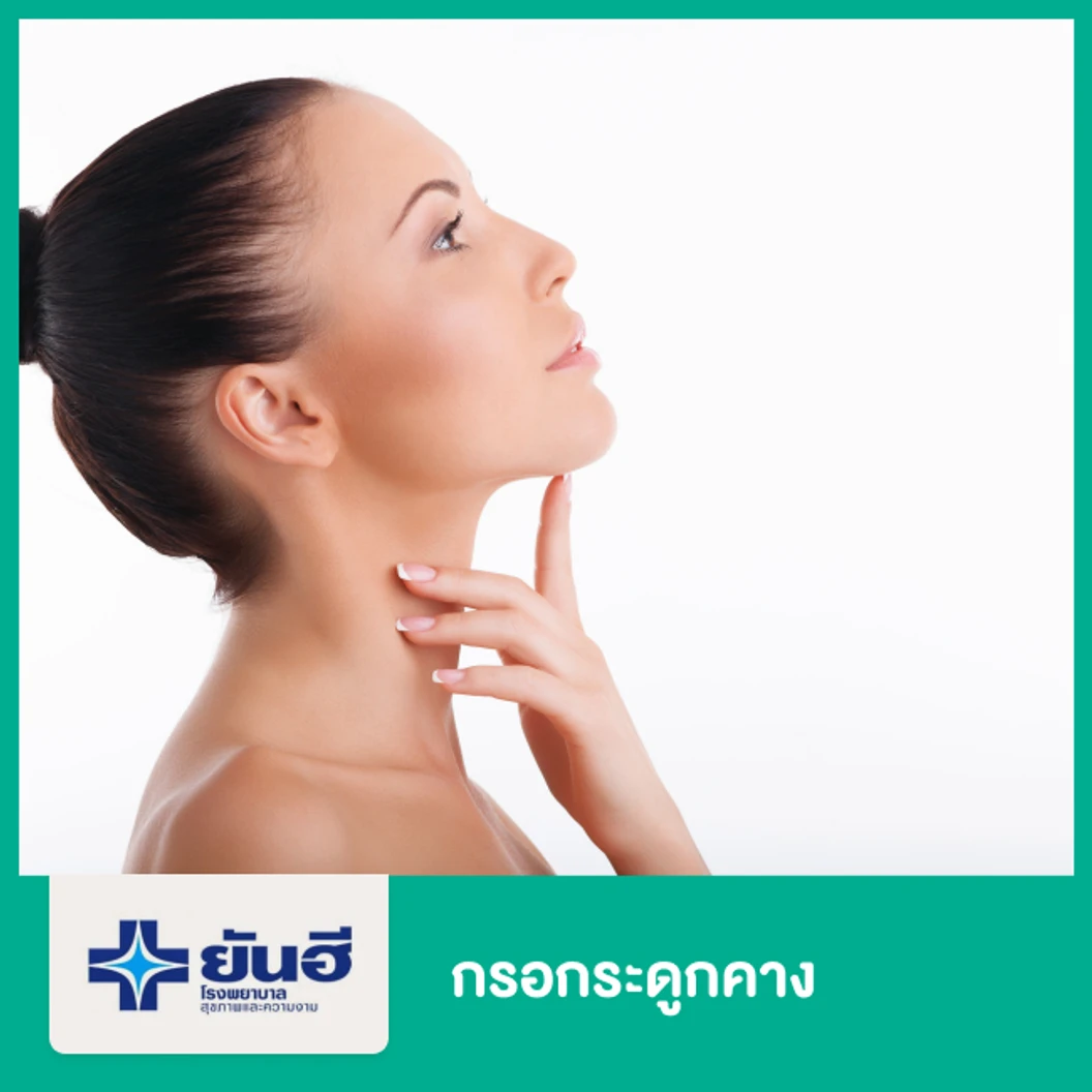 กรอกระดูกคาง (Chin Burring) เพิ่มจากการตัดหรือเลื่อนคาง