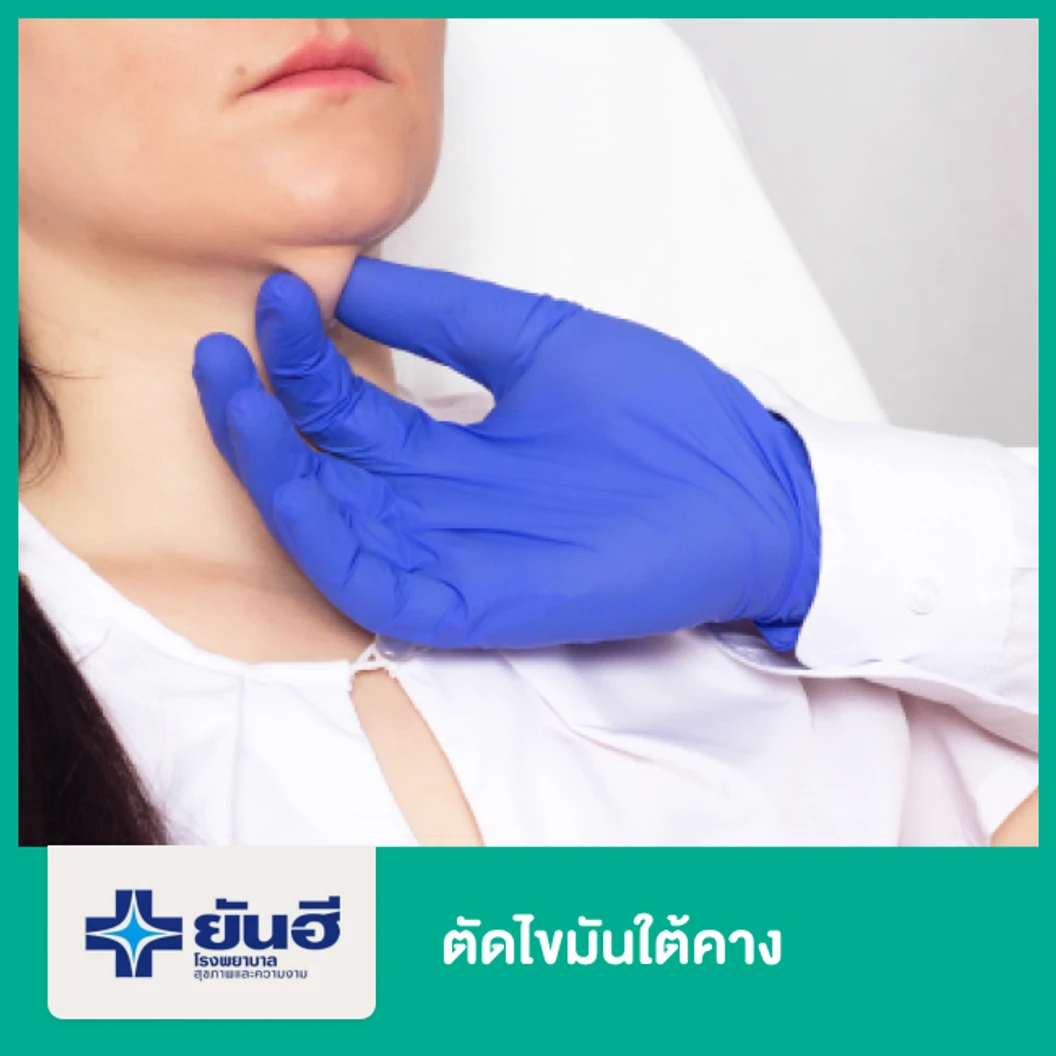 ตัดไขมันใต้คาง กระชับกล้ามเนื้อคอ