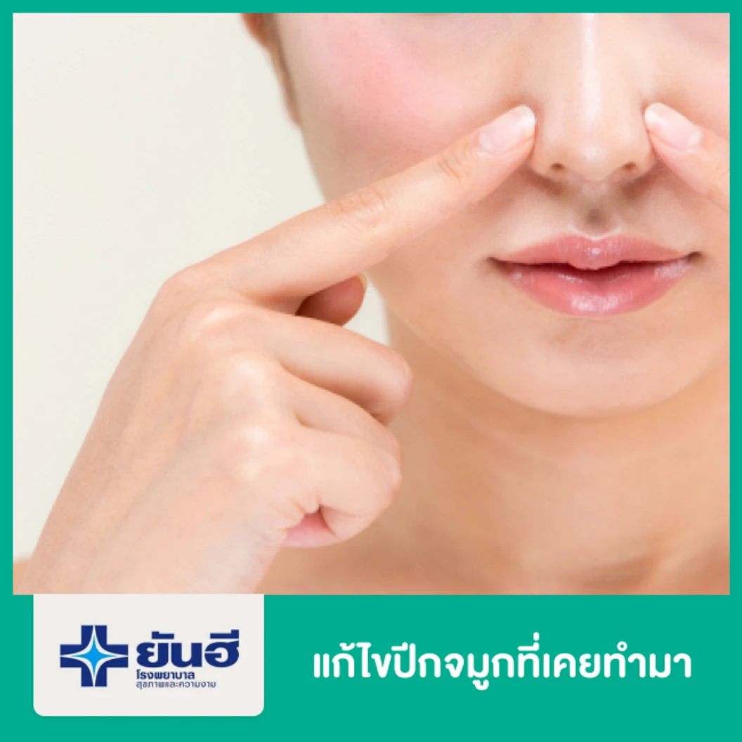 แก้ไขปีกจมูกที่เคยทำมา