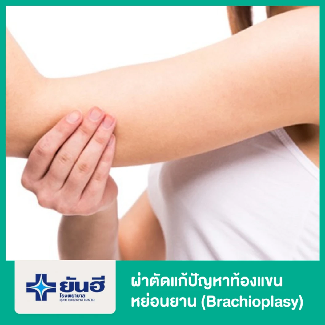 ผ่าตัดแก้ปัญหาท้องแขนหย่อนยาน (Brachioplasy) พักฟื้นรพ. 2 คืน