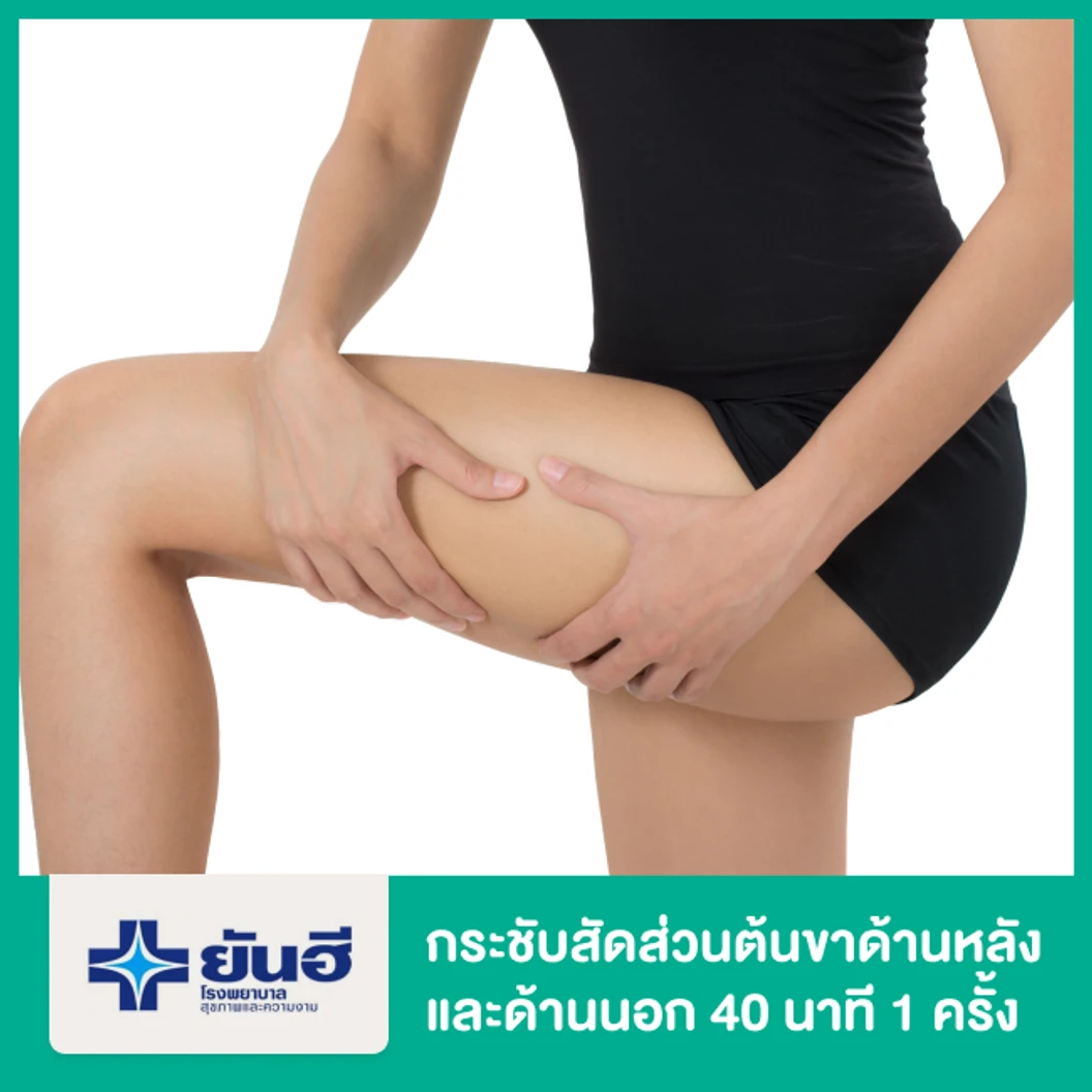 กระชับสัดส่วน ด้วยเครื่อง VelaShape (Vsmooth) บริเวณต้นขาด้านหลังและด้านนอก 40 นาที 1 ครั้ง