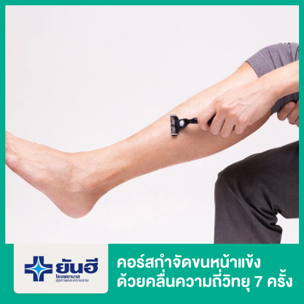 คอร์สกำจัดขนหน้าแข้ง ด้วยคลื่นความถี่วิทยุ สำหรับผู้หญิง 7 ครั้ง