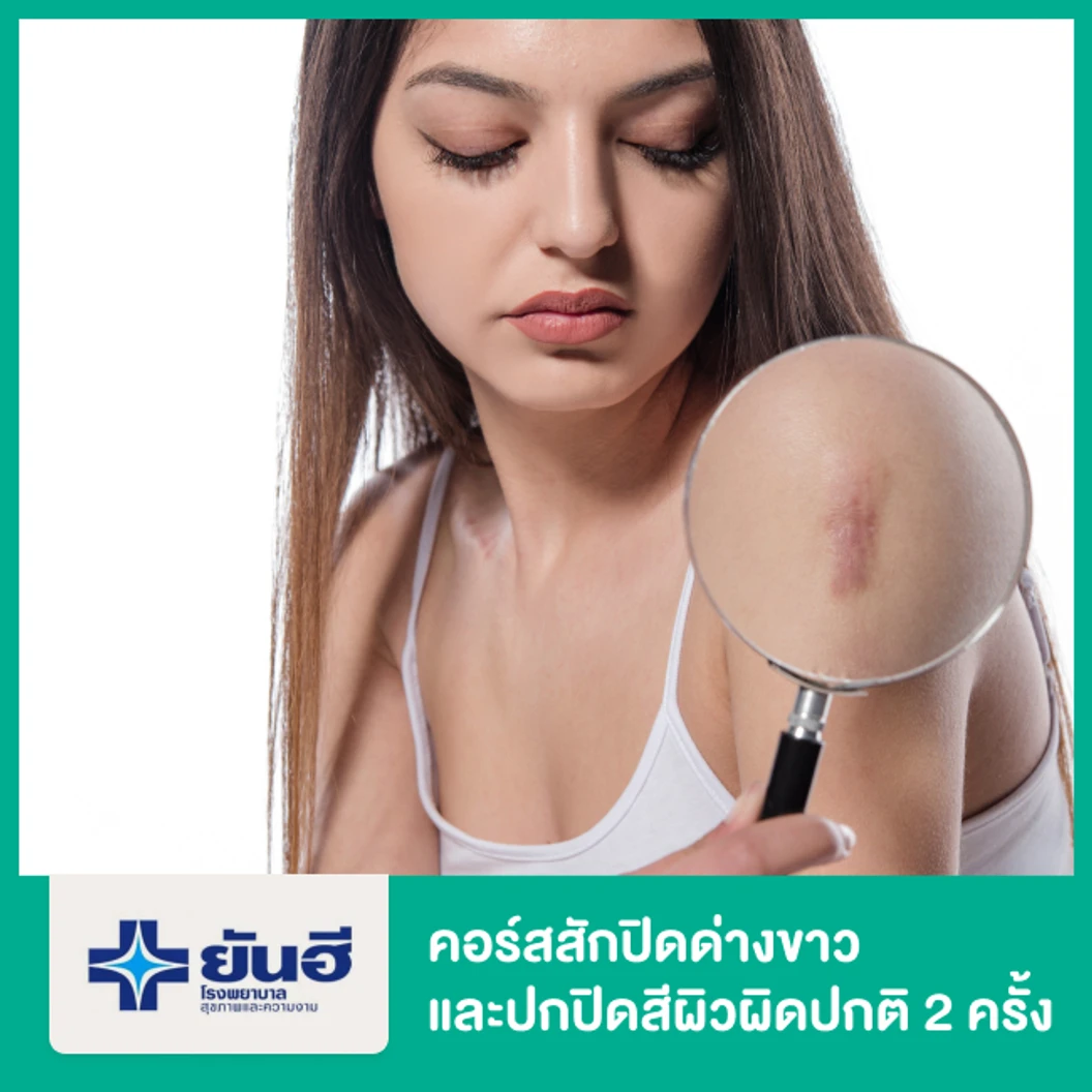 คอร์สสักปิดด่างขาว แผลเป็น ไฟไหม้ น้ำร้อนลวก และปกปิดสีผิวผิดปกติ 2 ครั้ง