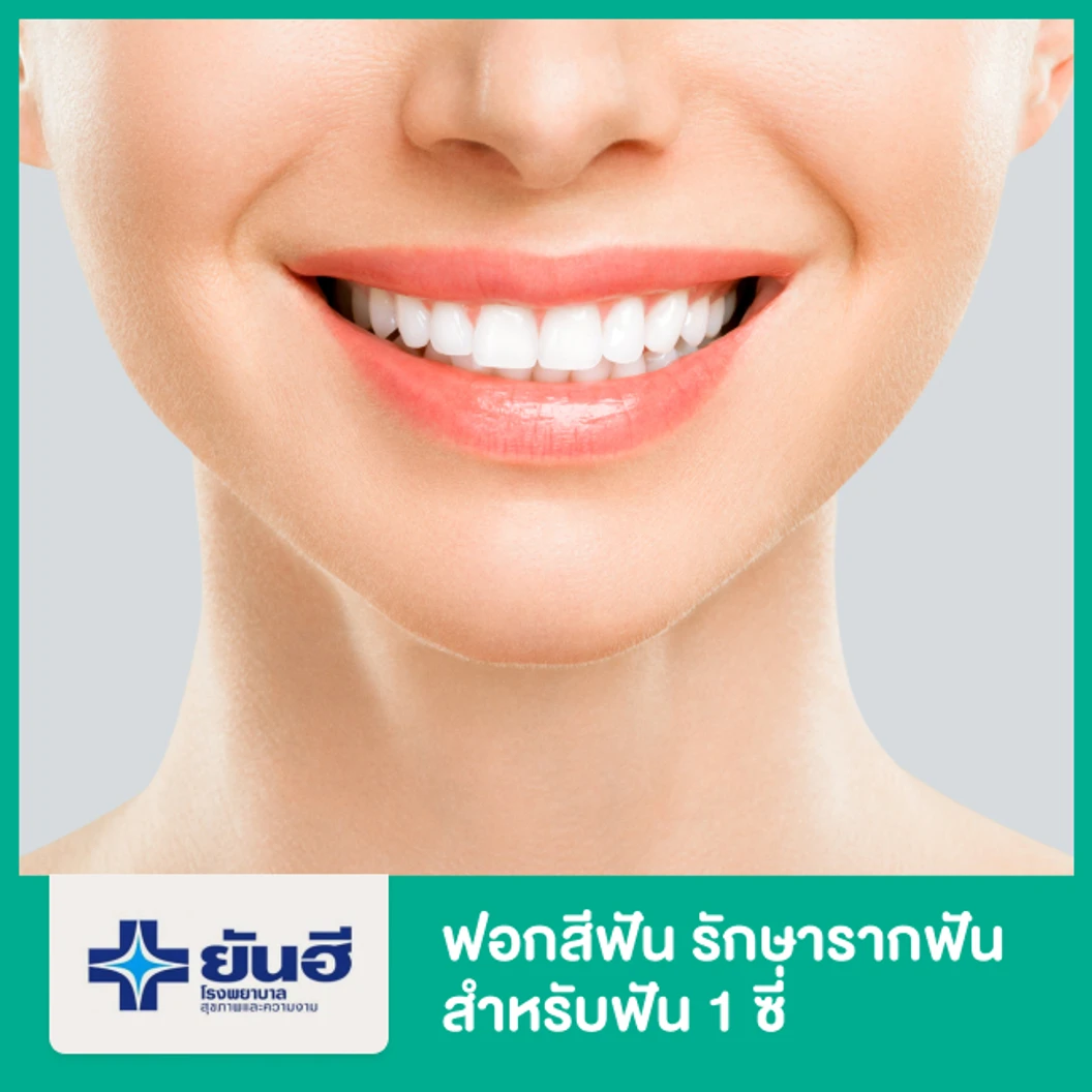 ฟอกสีฟัน รักษารากฟัน (Non-Vital Bleaching) สำหรับฟัน 1 ซี่