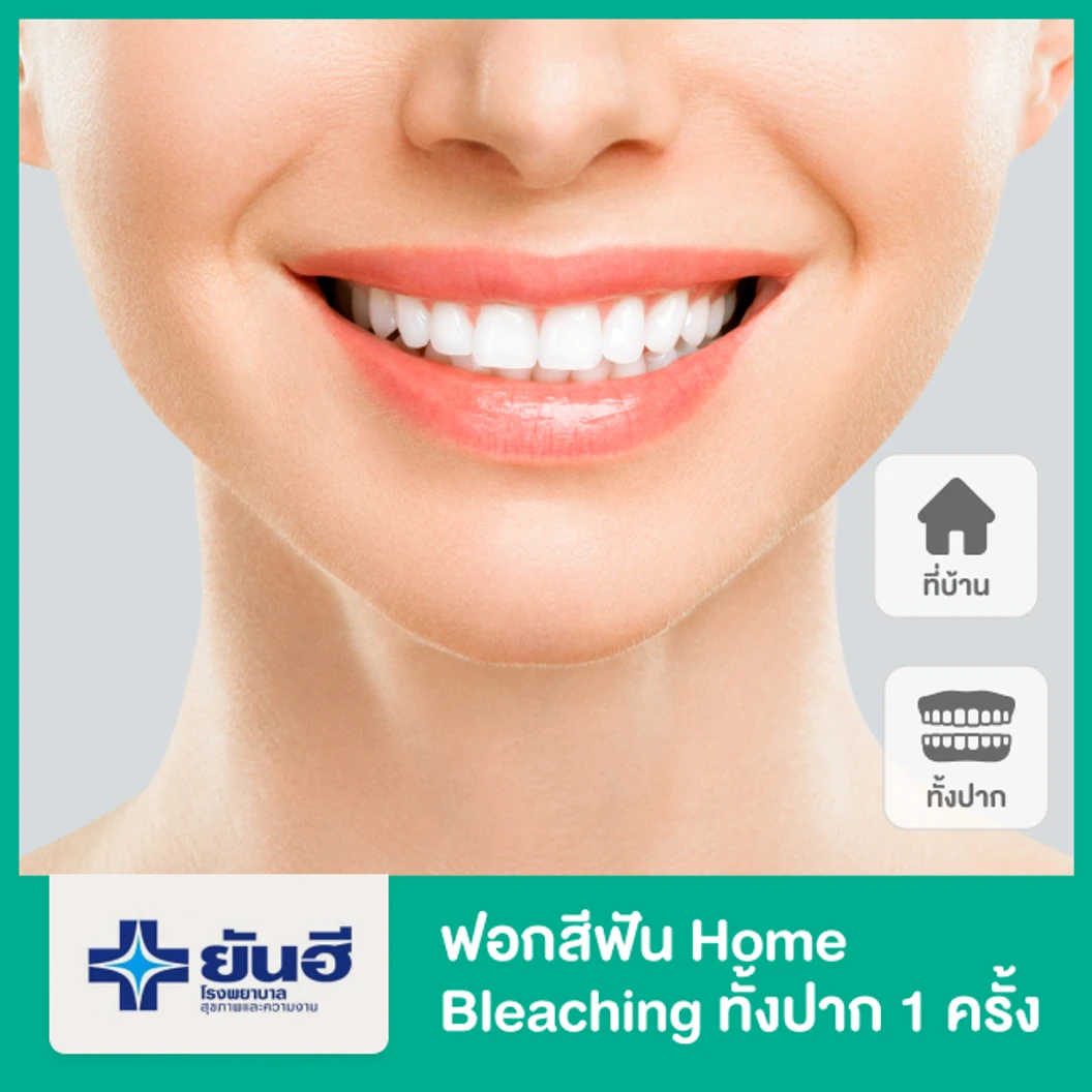 ฟอกสีฟัน Home Bleaching ทั้งปาก 1 ครั้ง