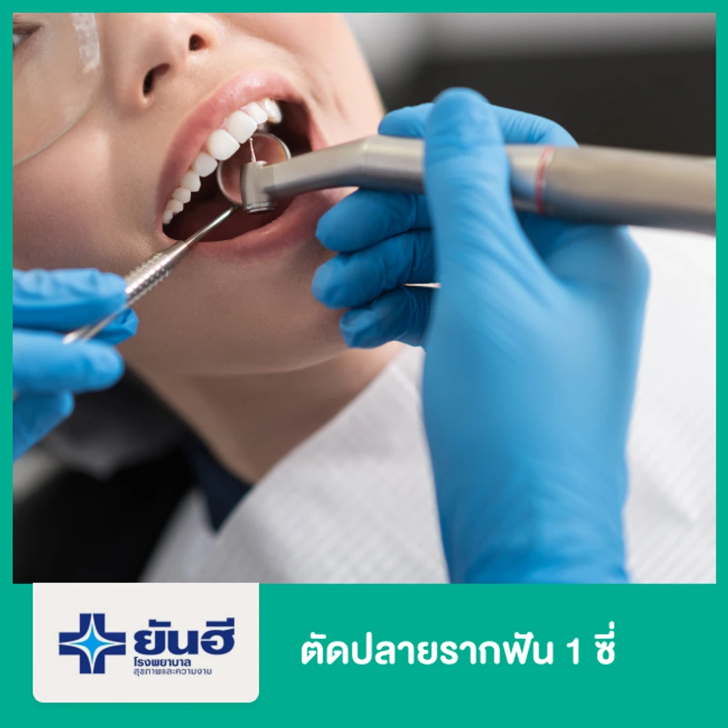 ตัดปลายรากฟัน 1 ซี่