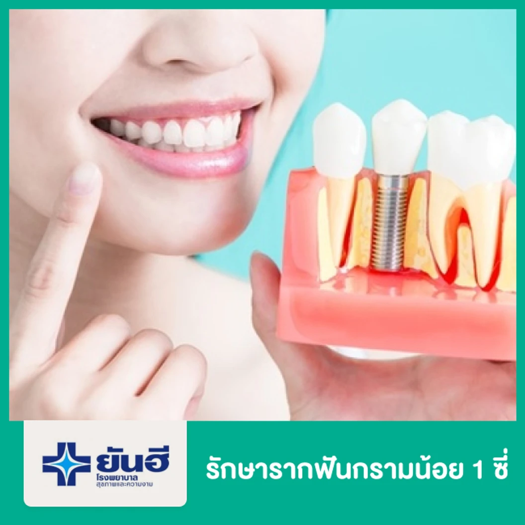 รักษารากฟันกรามน้อย 1 ซี่