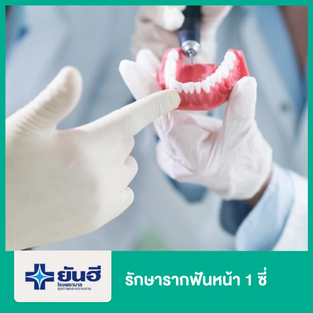 รักษารากฟันหน้า 1 ซี่