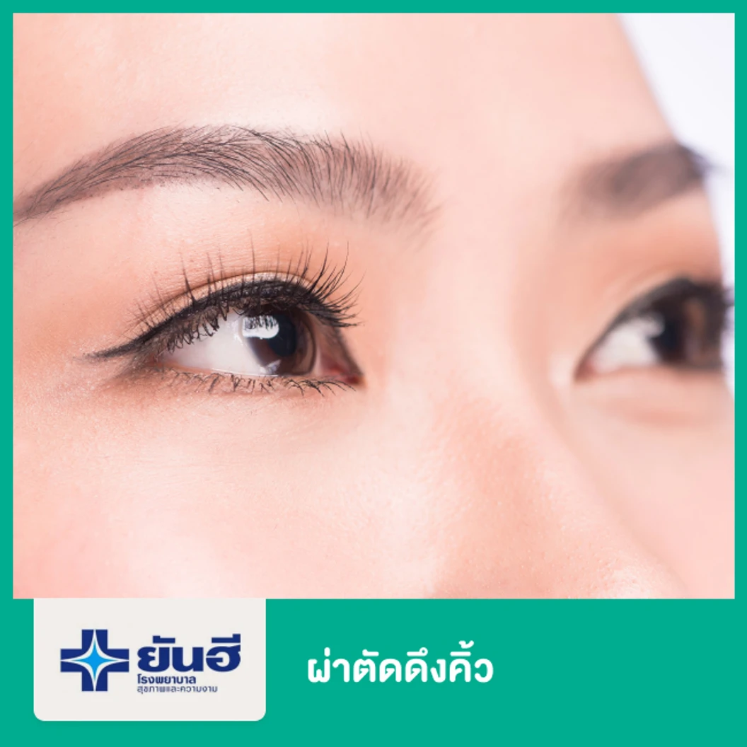 ดึงคิ้ว