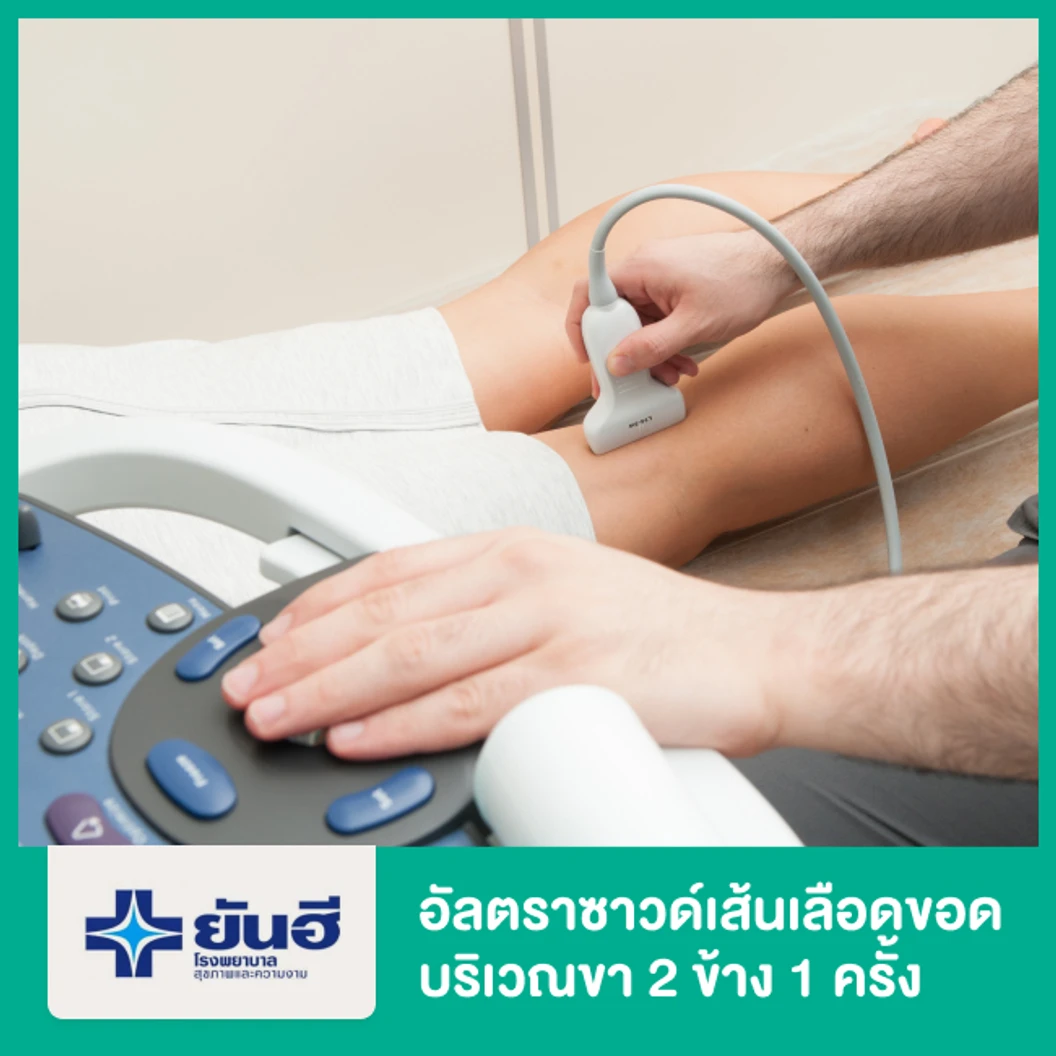 อัลตราซาวด์เส้นเลือดขอดบริเวณขา 2 ข้าง 1 ครั้ง