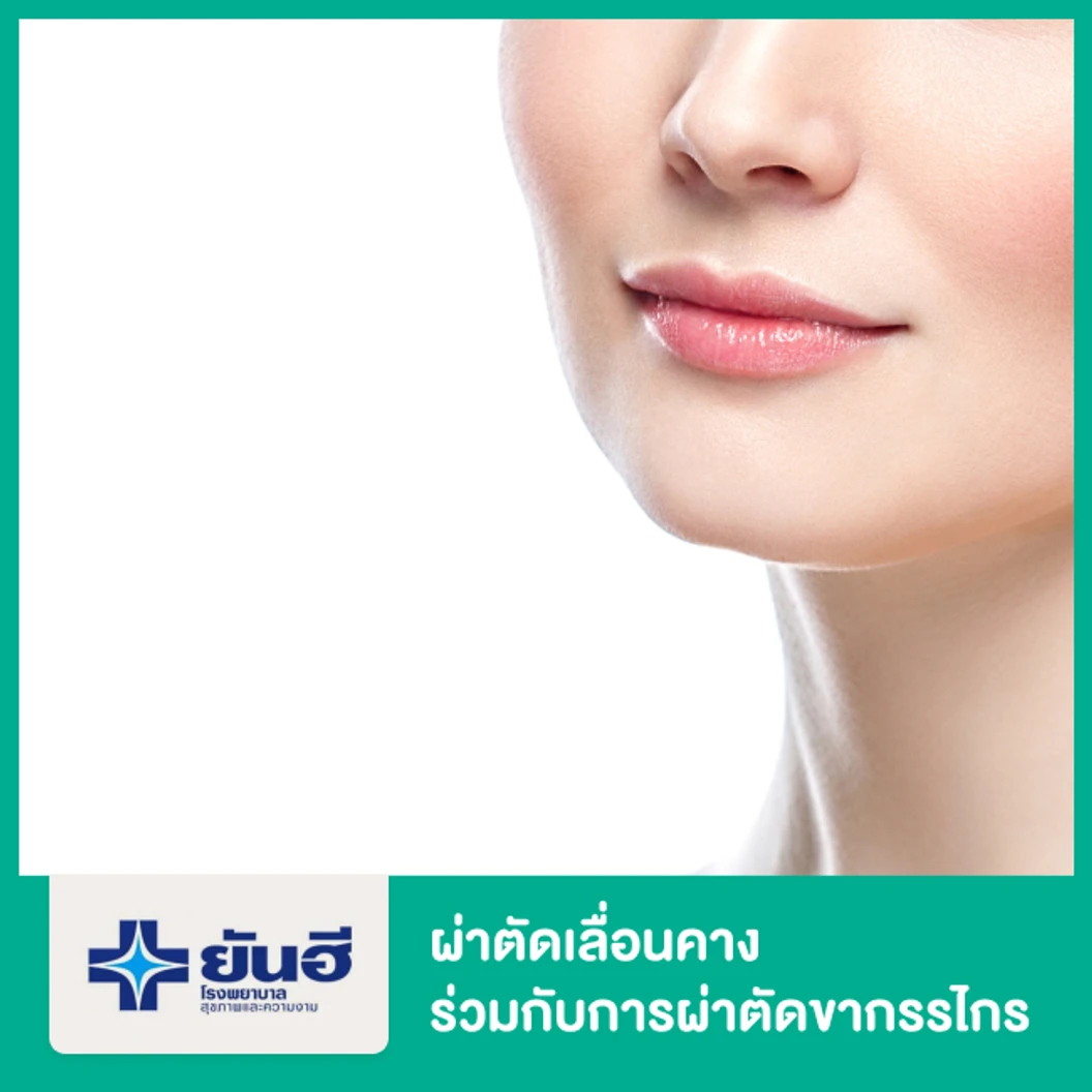 ผ่าตัดเลื่อนคาง ร่วมกับการผ่าตัดขากรรไกร