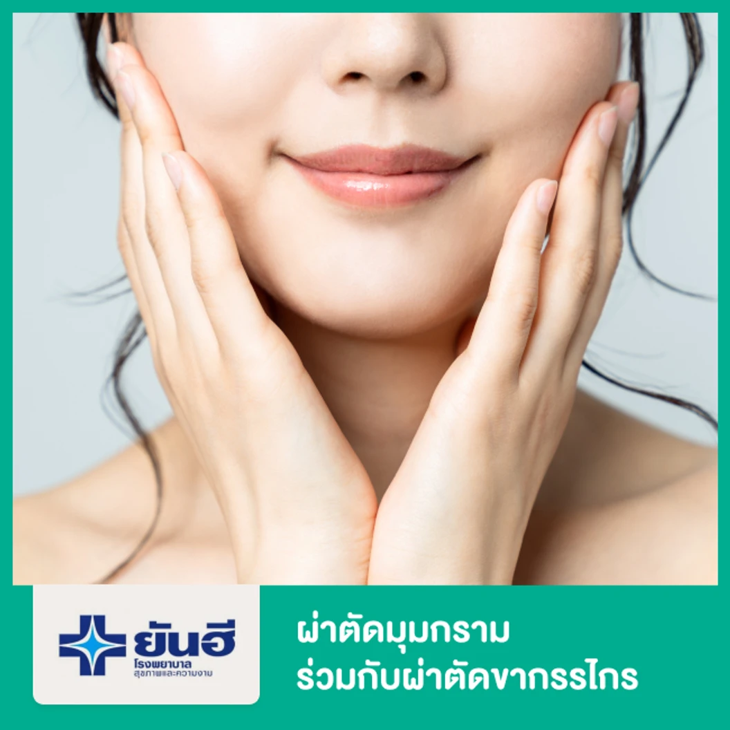 ผ่าตัดมุมกราม กรณีทำร่วมกับผ่าตัดขากรรไกร