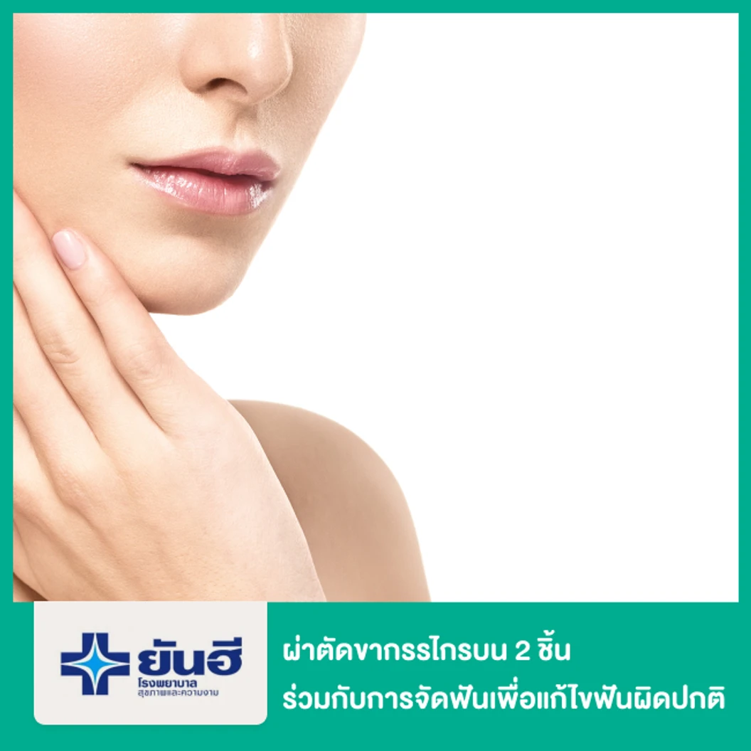 ผ่าตัดขากรรไกรบน 2 ชิ้น กรณีทำร่วมกับการจัดฟันเพื่อแก้ไขฟันผิดปกติ