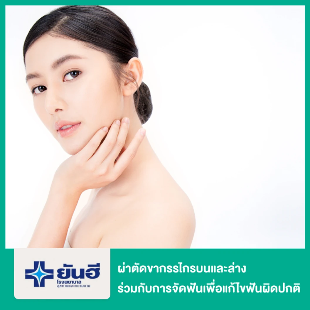 ผ่าตัดขากรรไกรบนและล่าง กรณีทำร่วมกับการจัดฟันเพื่อแก้ไขฟันผิดปกติ