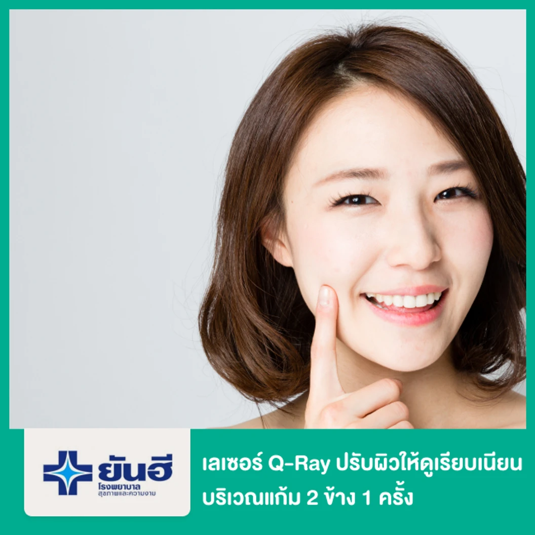 เลเซอร์ Q-Ray ปรับผิวให้ดูเรียบเนียน แก้ปัญหาหลุมสิว บริเวณแก้ม 2 ข้าง 1 ครั้ง