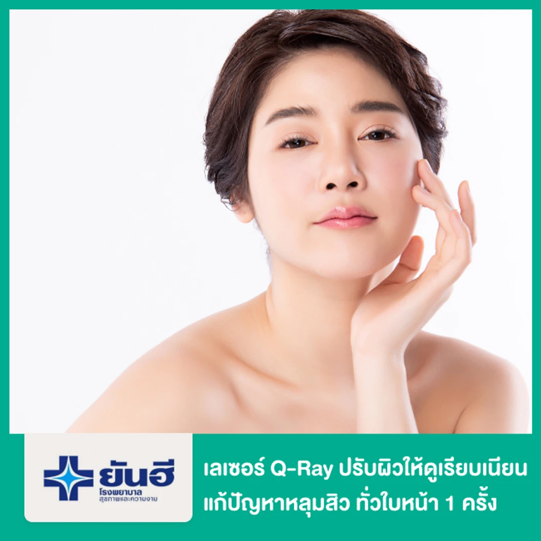 เลเซอร์ Q-Ray ปรับผิวให้ดูเรียบเนียน แก้ปัญหาหลุมสิว ทั่วใบหน้า 1 ครั้ง