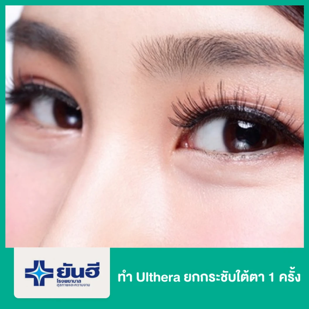 ทำ Ulthera ยกกระชับใต้ตา 1 ครั้ง
