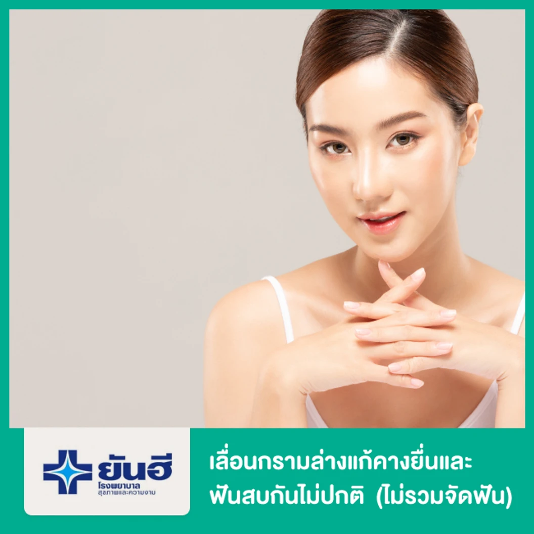 เลื่อนกรามล่างแก้คางยื่นและฟันสบกันไม่ปกติ (ไม่รวมจัดฟัน)