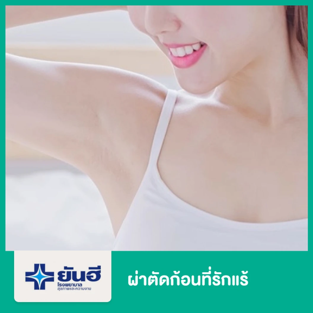 ผ่าตัดก้อนที่รักแร้เพื่อการรักษา 1 ข้าง (ดมยาสลบ) พักรพ. 2 วัน 1 คืน