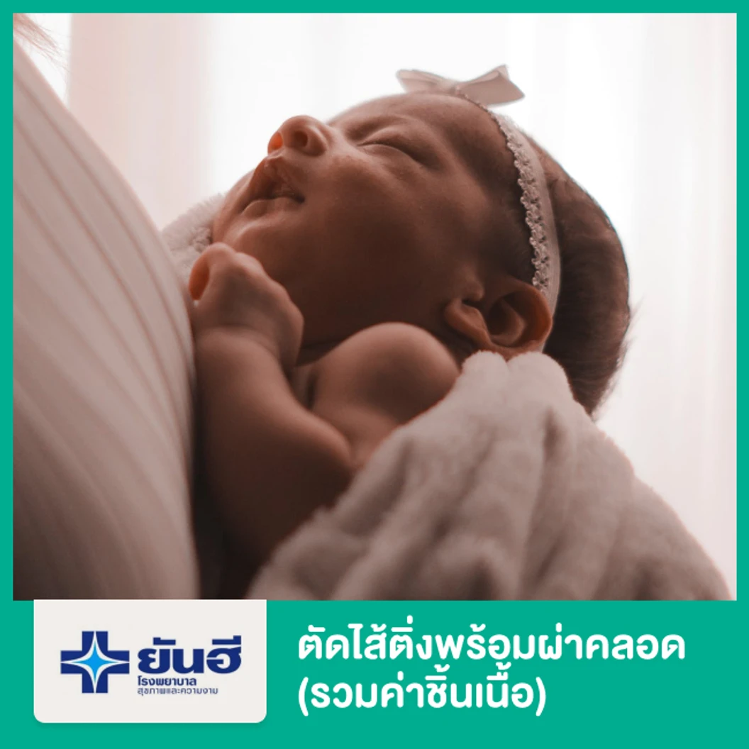 ตัดไส้ติ่ง (รวมค่าชิ้นเนื้อ) กรณีทำพร้อมผ่าคลอด