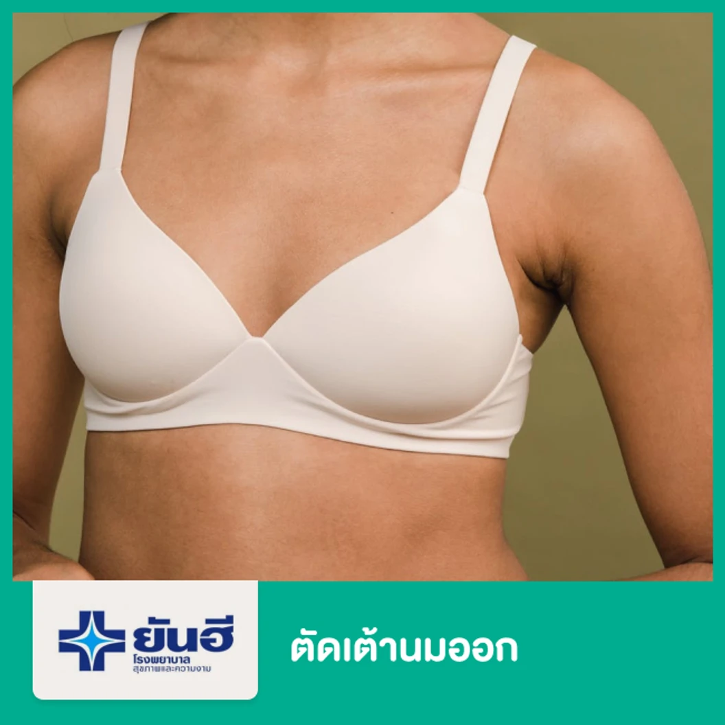ตัดเต้านมออก สำหรับผู้ป่วยมะเร็งเต้านม นอนรพ. 3 คืน