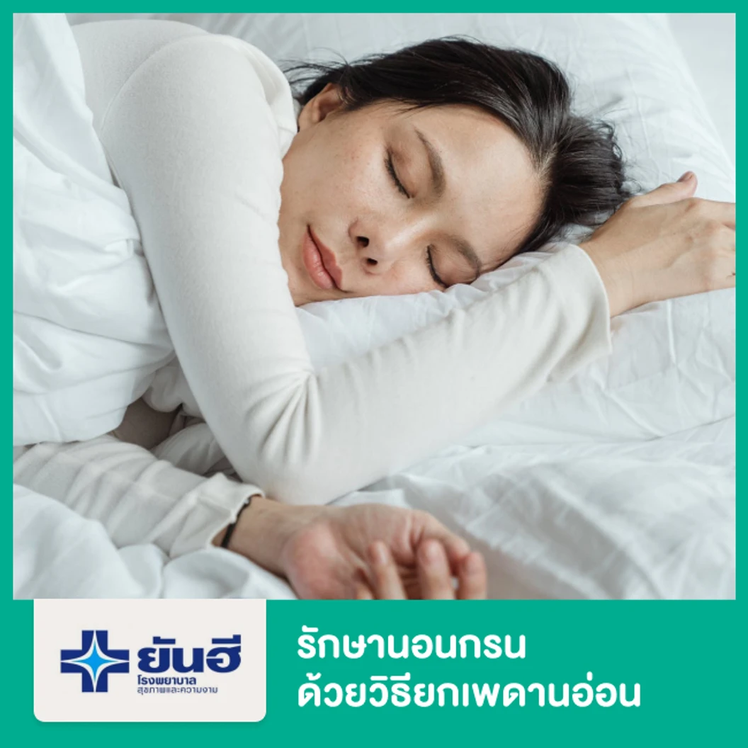 รักษานอนกรน ด้วยวิธียกเพดานอ่อน