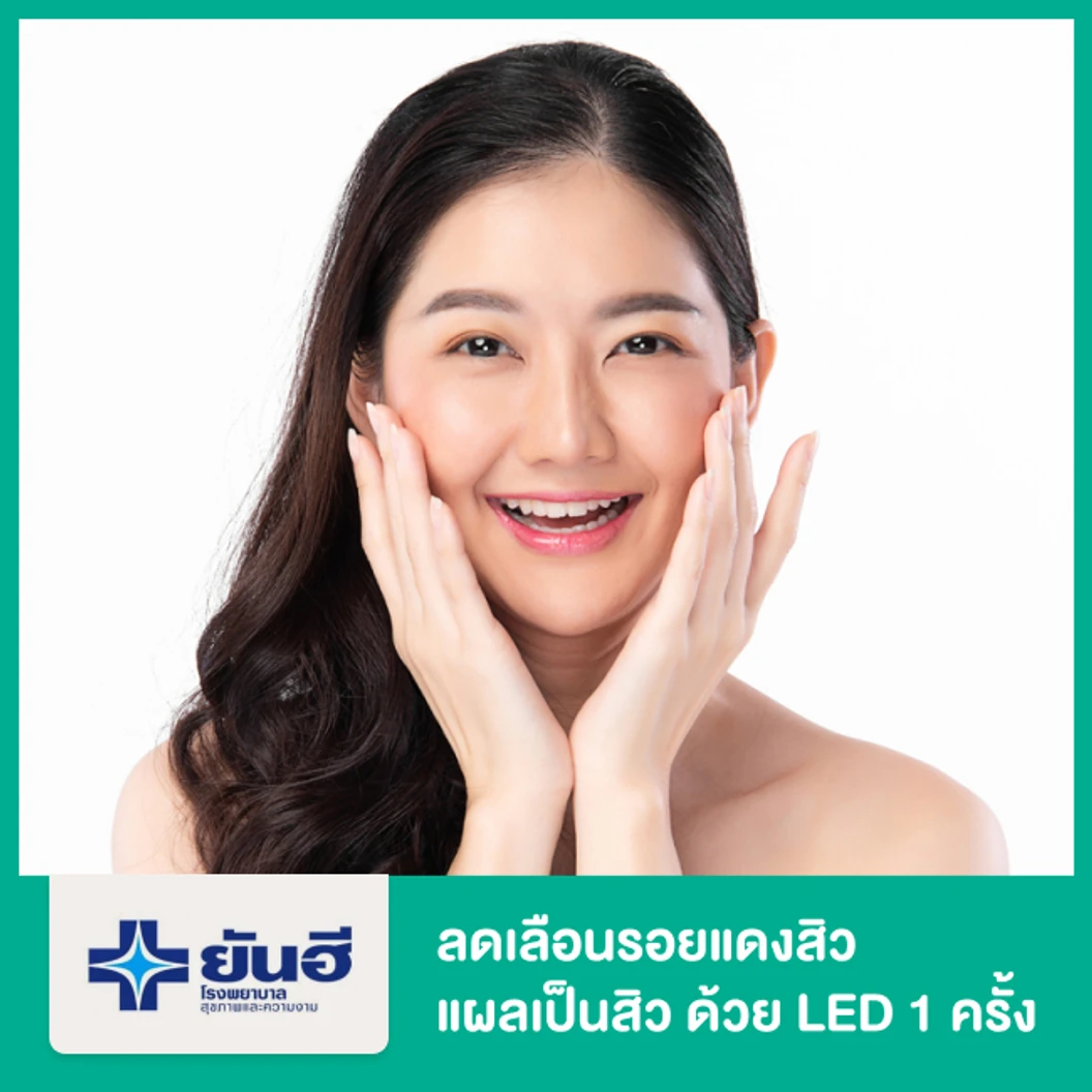 ลดเลือนรอยแดงสิว แผลเป็นสิว ด้วย LED 1 ครั้ง