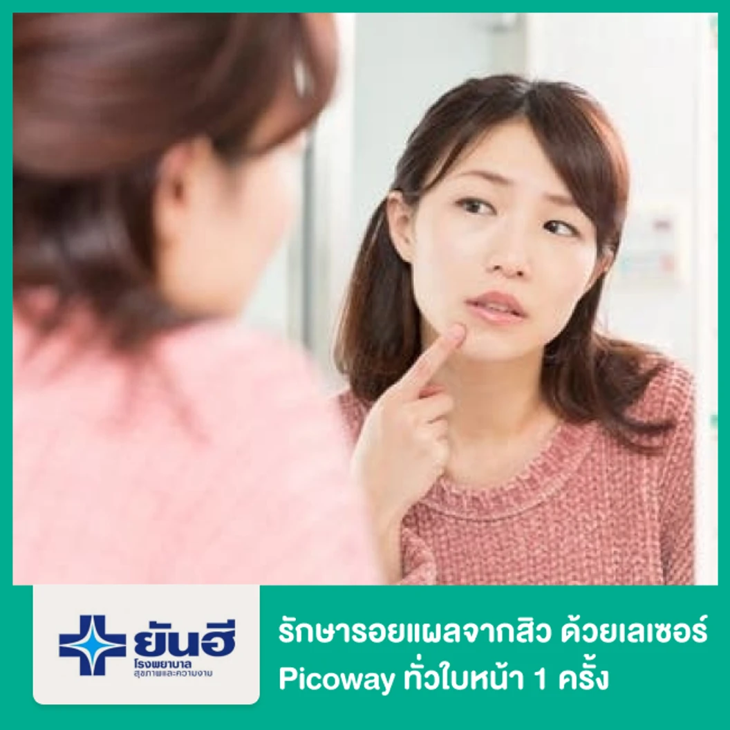 รักษารอยแผลจากสิว ด้วยเลเซอร์ Picoway ทั่วใบหน้า 1 ครั้ง