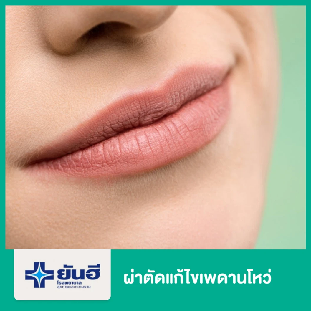 ผ่าตัดแก้ไขเพดานโหว่