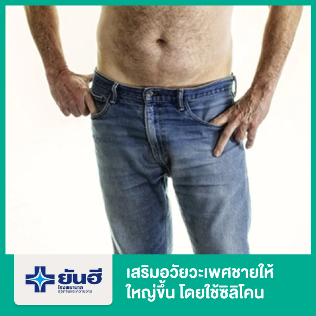 เสริมอวัยวะเพศชายให้ใหญ่ขึ้น โดยใช้ซิลิโคน