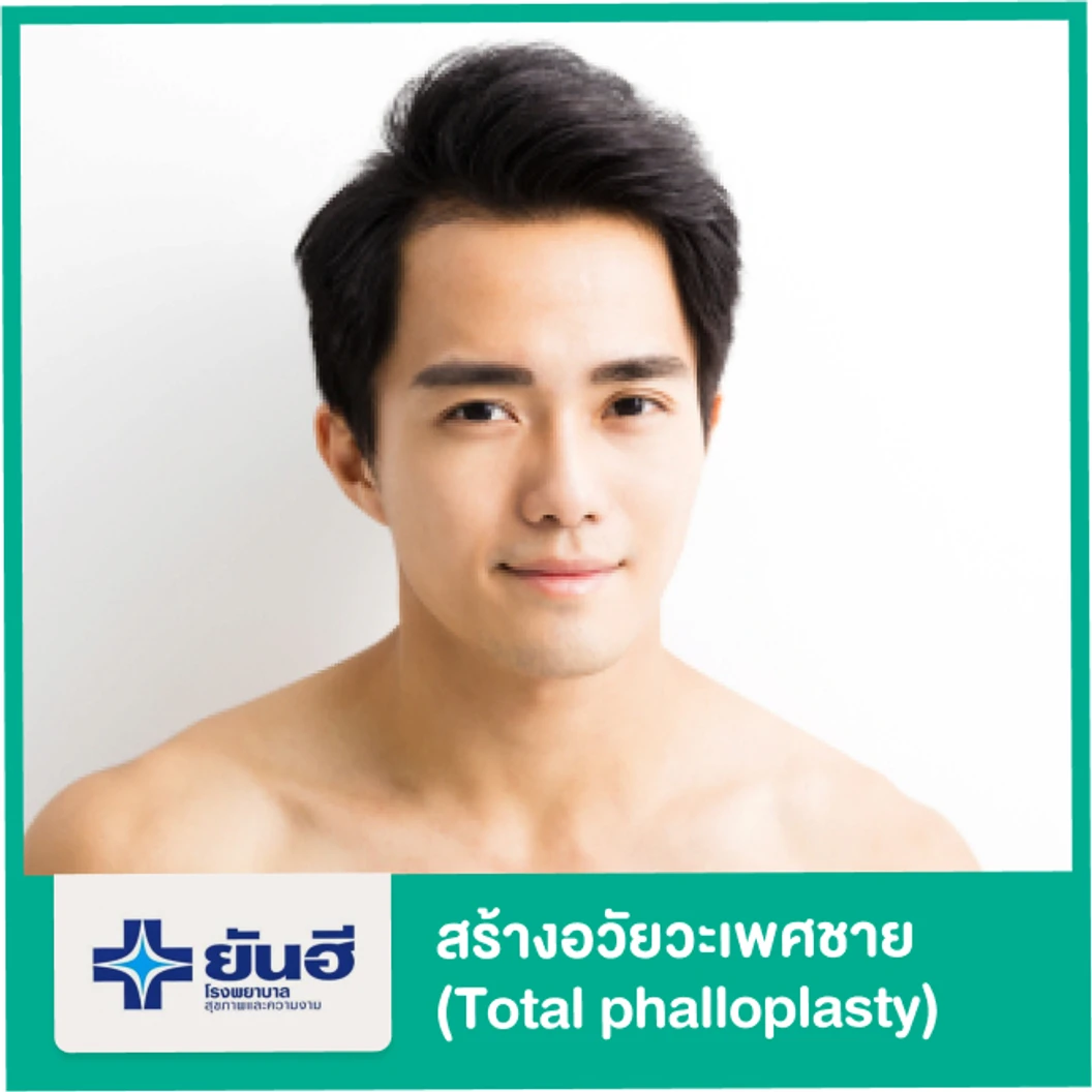 สร้างอวัยวะเพศชาย Total phalloplasty สำหรับแปลงเพศจากหญิงเป็นชาย นอนรพ. 14 คืน