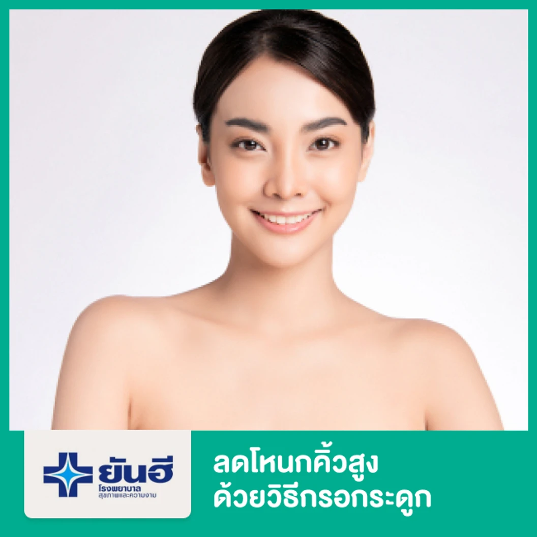 ลดโหนกคิ้วสูง ด้วยวิธีกรอกระดูก