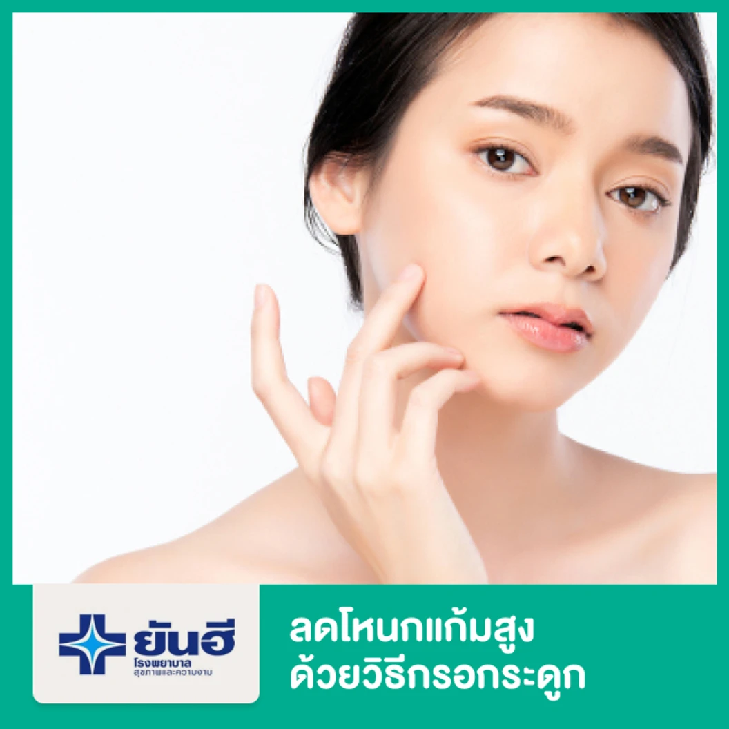 ลดโหนกแก้มสูง ด้วยวิธีกรอกระดูก พักฟื้นรพ. 1 คืน