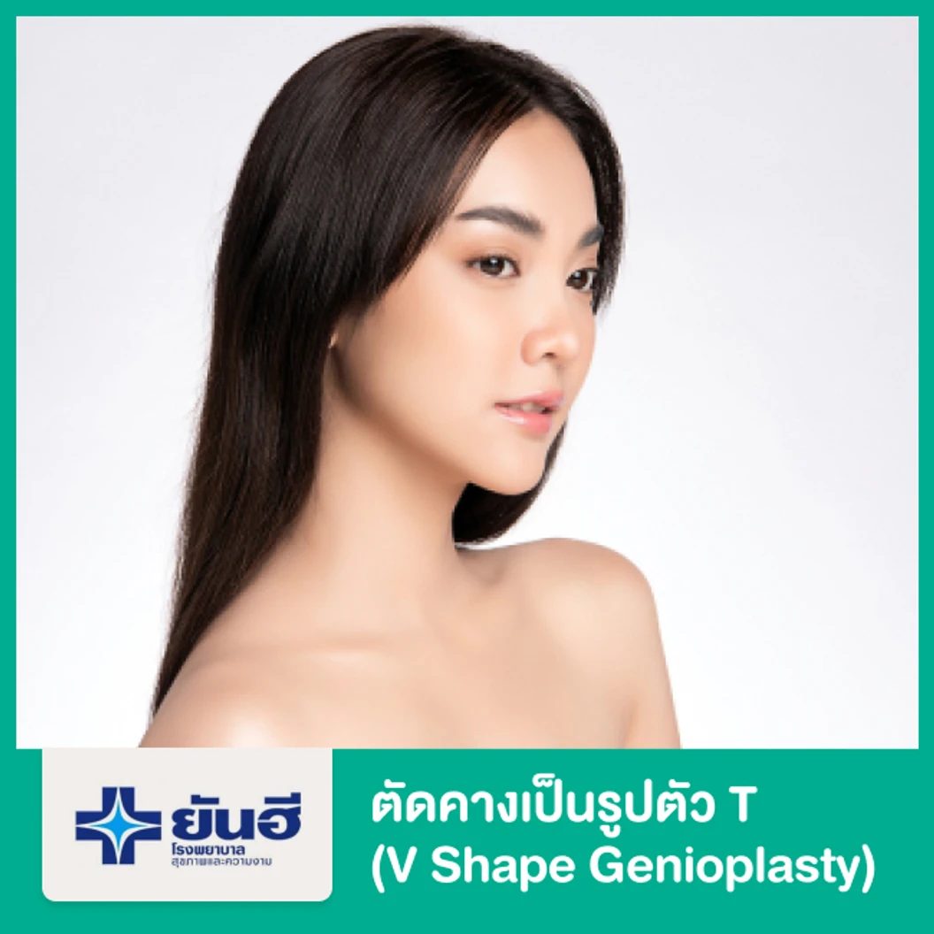 ตัดคางเป็นรูปตัว T (V Shape Genioplasty)