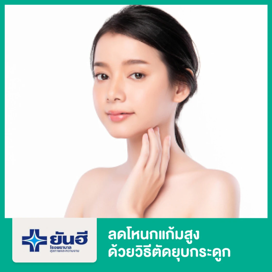 ลดโหนกแก้มสูง ด้วยวิธีตัดยุบกระดูก พักฟื้นรพ. 2 คืน