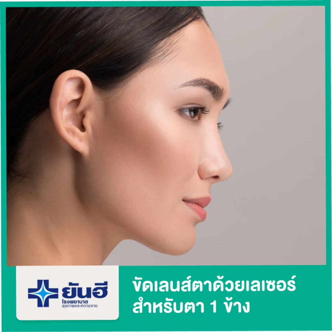 ขัดเลนส์ตาด้วยเลเซอร์ เทคนิค PRK สำหรับตา 1 ข้าง