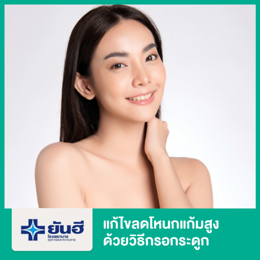 แก้ไขลดโหนกแก้มสูง ด้วยวิธีกรอกระดูก พักฟื้นรพ. 1 คืน