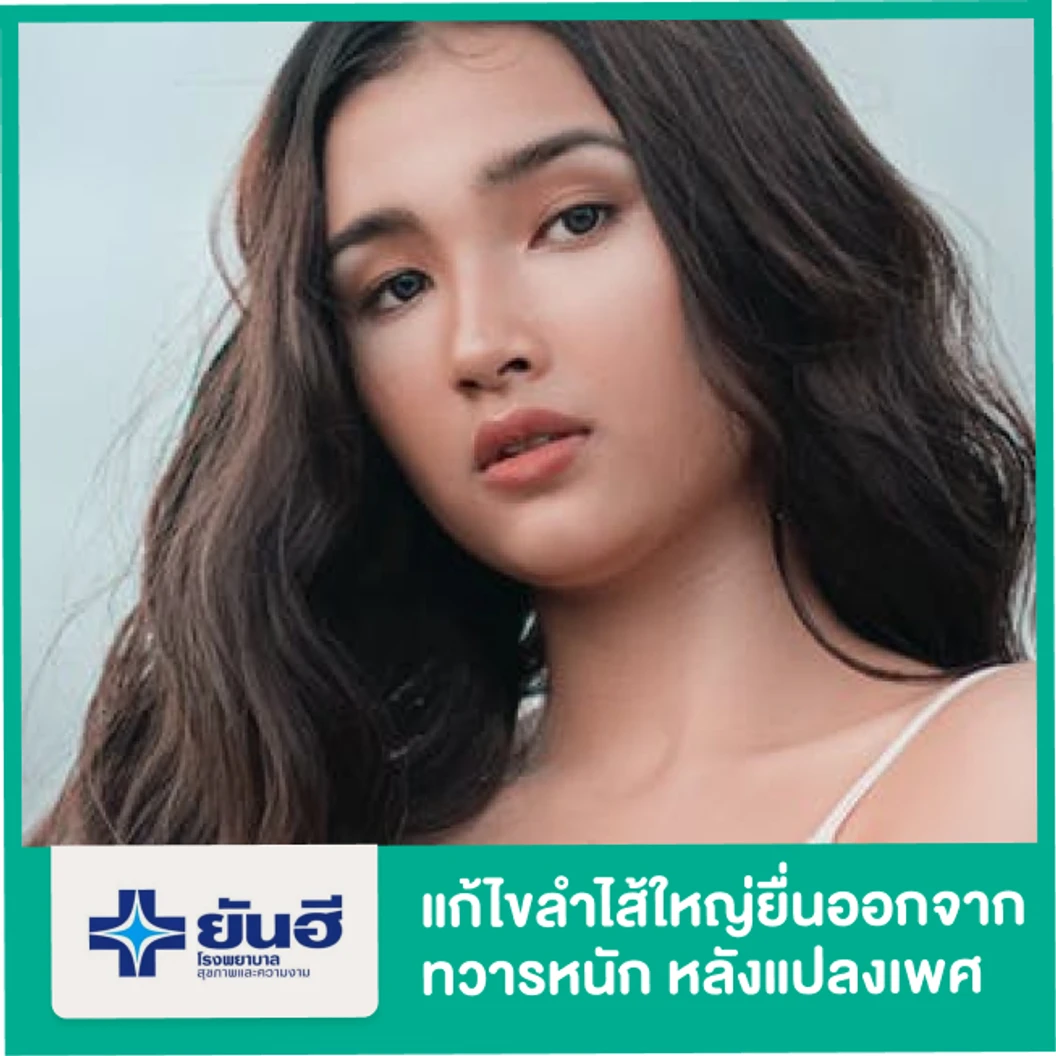 แก้ไขลำไส้ใหญ่ยื่นออกจากทวารหนัก (Prolapse Rectum) หลังผ่าตัดแปลงเพศ