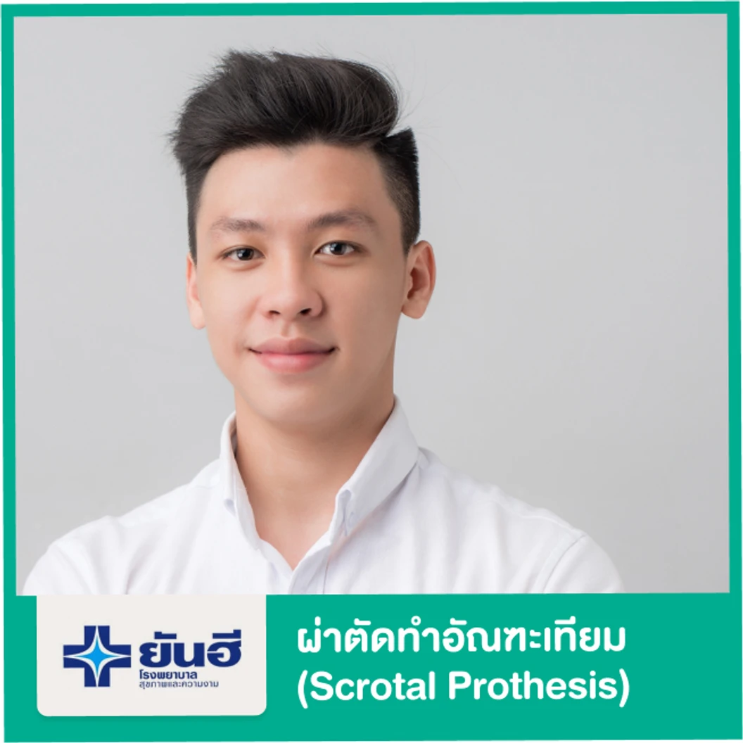 ผ่าตัดทำอัณฑะเทียม (Scrotal Prothesis) ยังไม่รวมค่าอวัยวะเทียม