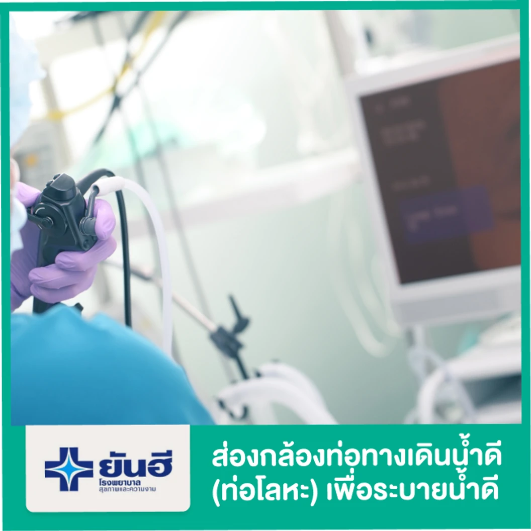ส่องกล้องตรวจท่อทางเดินน้ำดีและท่อตับอ่อน (ERCP) ด้วยท่อโลหะ เพื่อระบายน้ำดี
