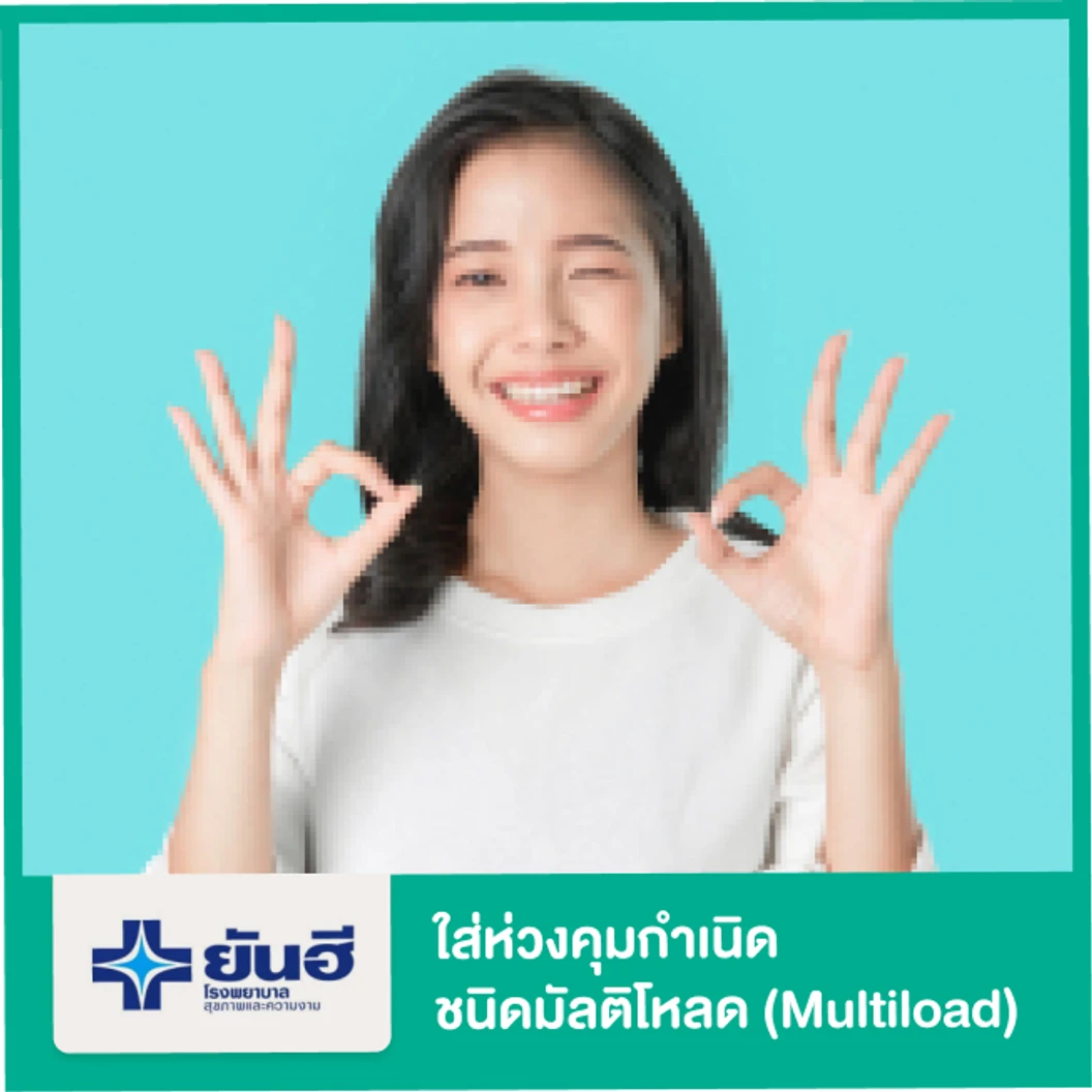 ใส่ห่วงคุมกำเนิดชนิดมัลติโหลด (Multiload) สำหรับผู้หญิง
