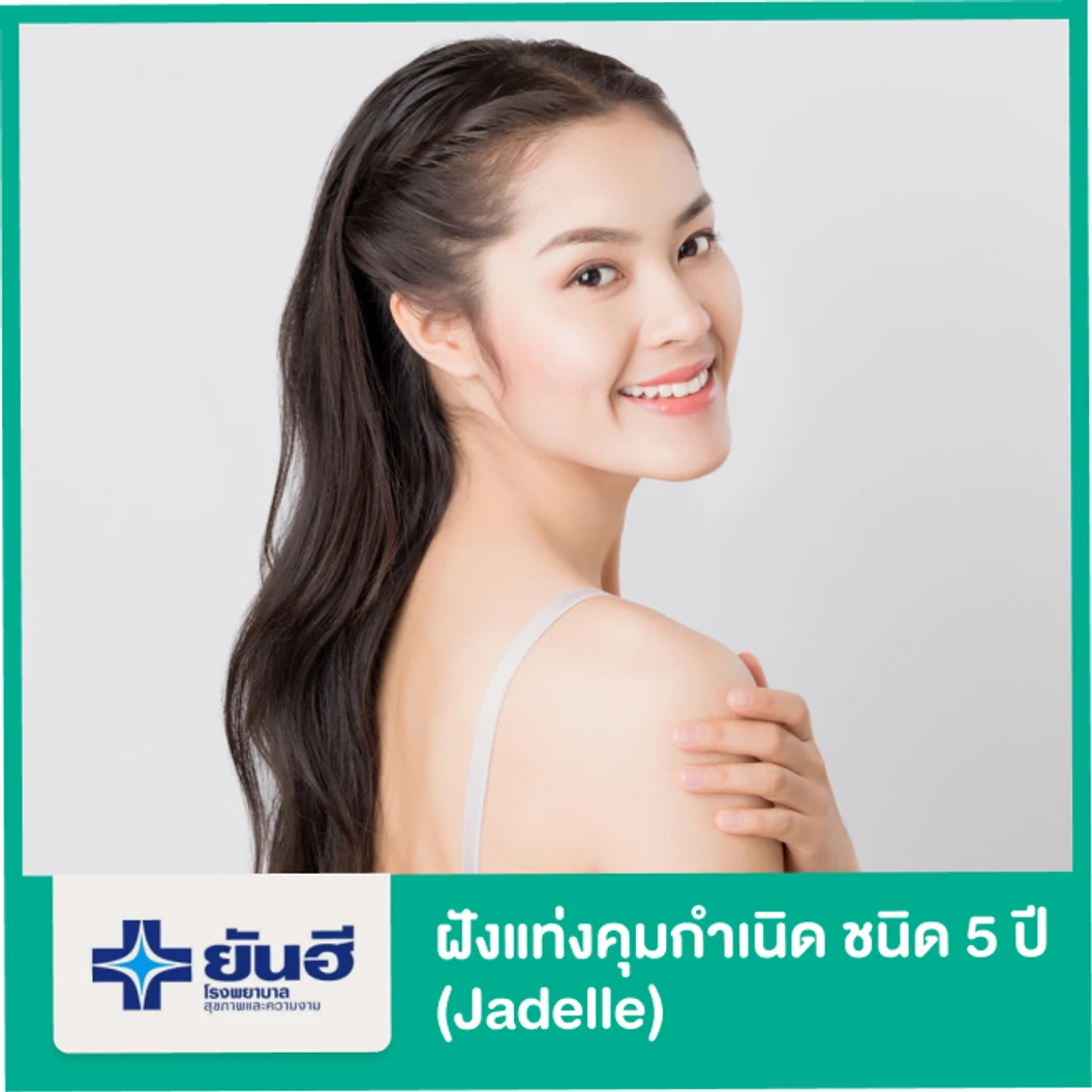 ฝังแท่งคุมกำเนิดชนิด 5 ปี (Jadelle) สำหรับผู้หญิง