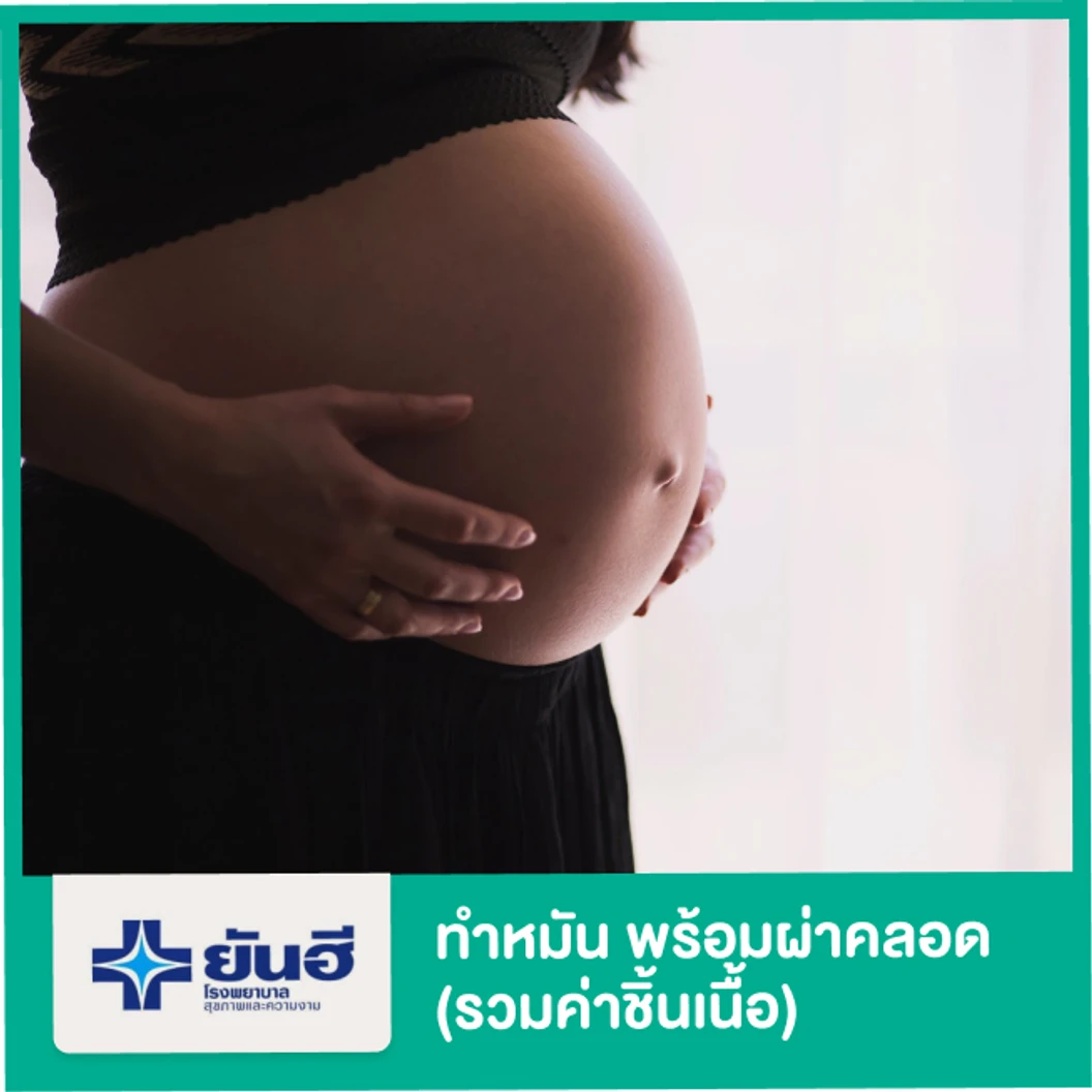 ทำหมัน พร้อมกับการผ่าคลอด