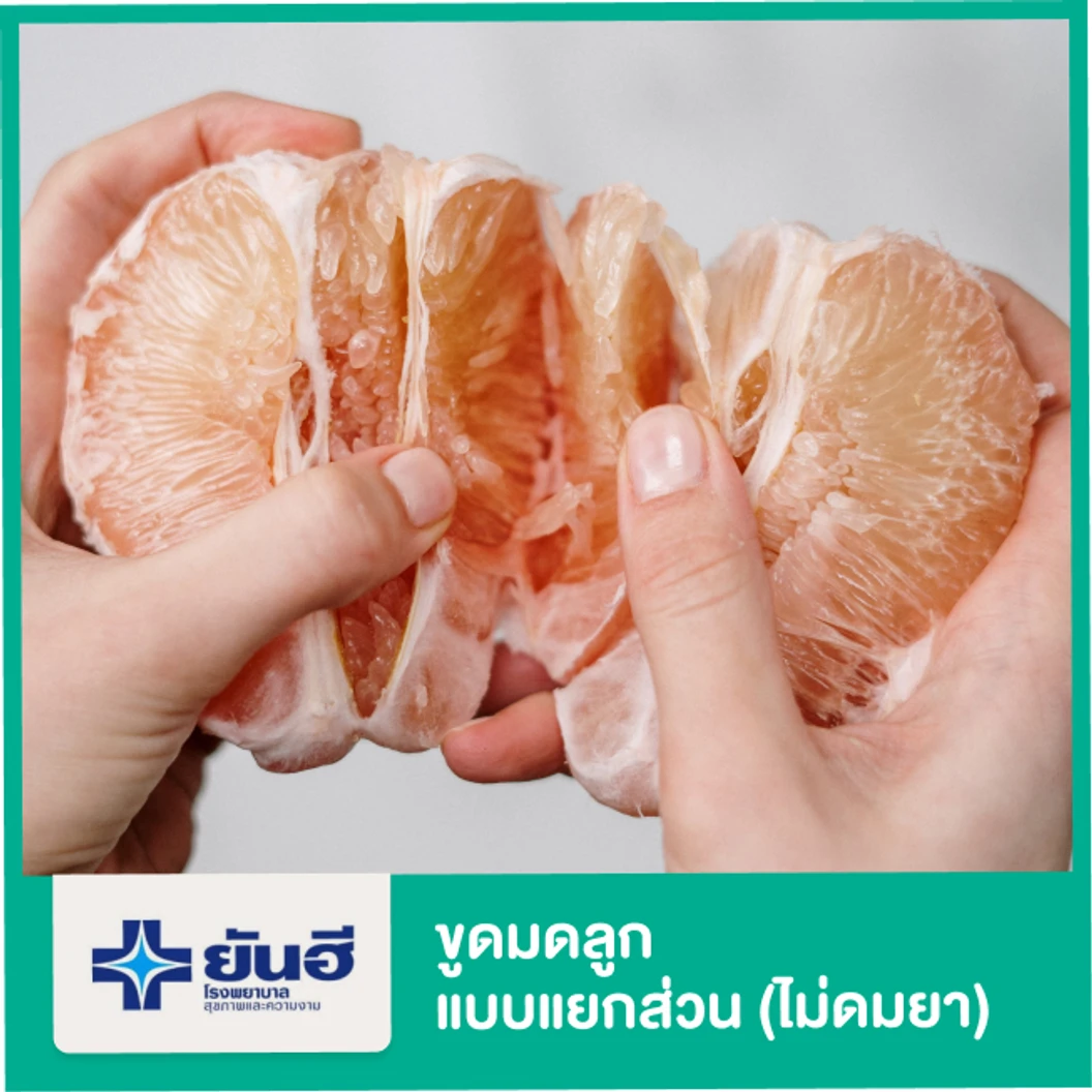 ขูดมดลูกแบบแยกส่วน (ไม่ดมยา)