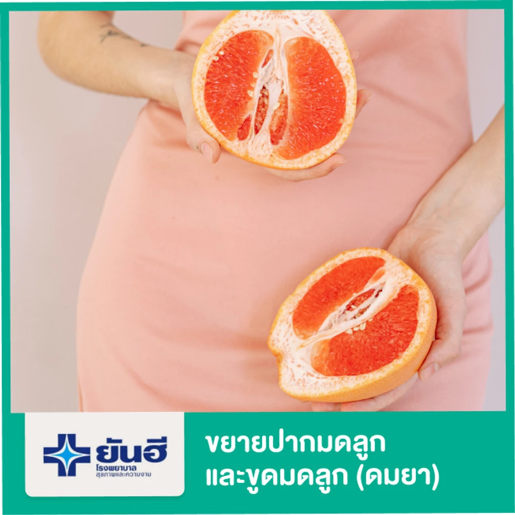 ขยายปากมดลูกและขูดมดลูก (ดมยา)