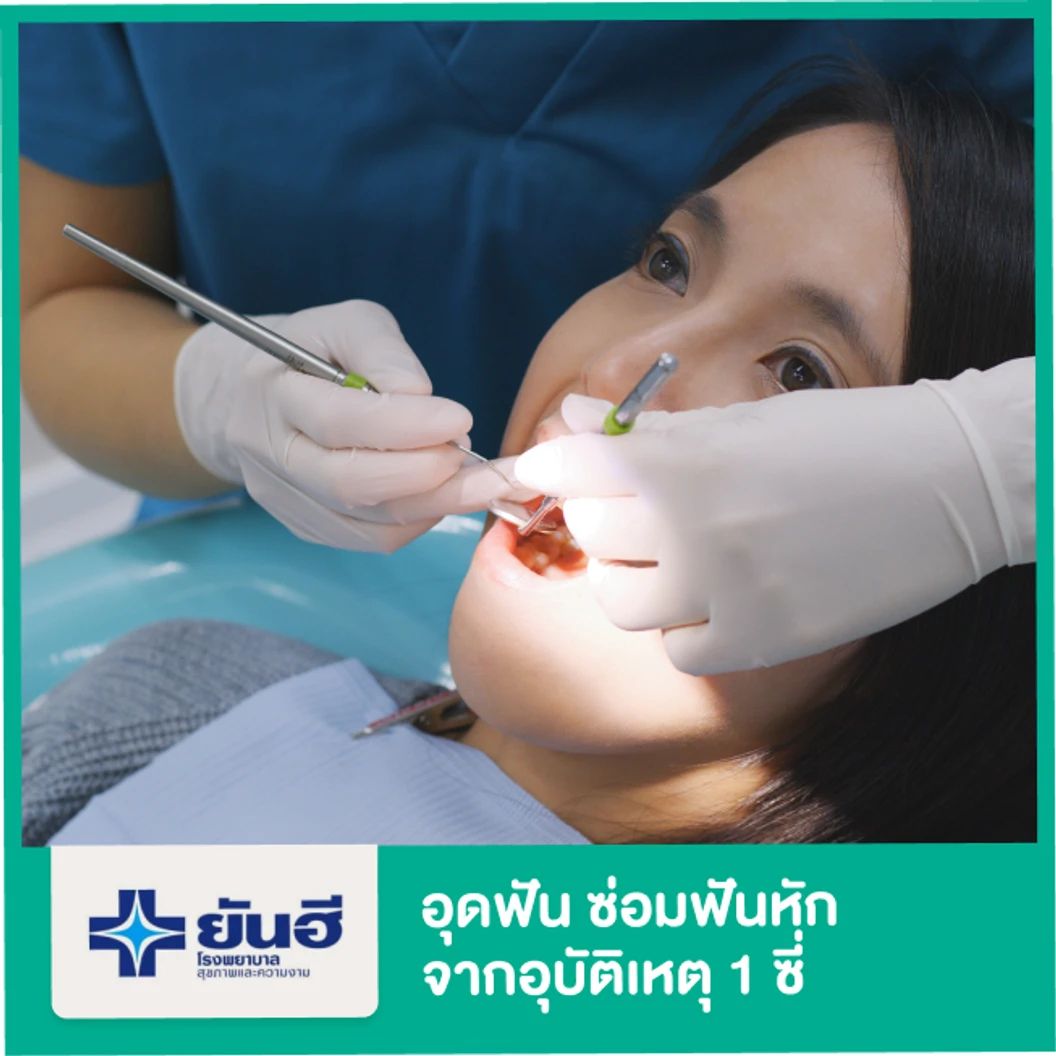 อุดฟันซ่อมฟันหักจากอุบัติเหตุ 1 ซี่