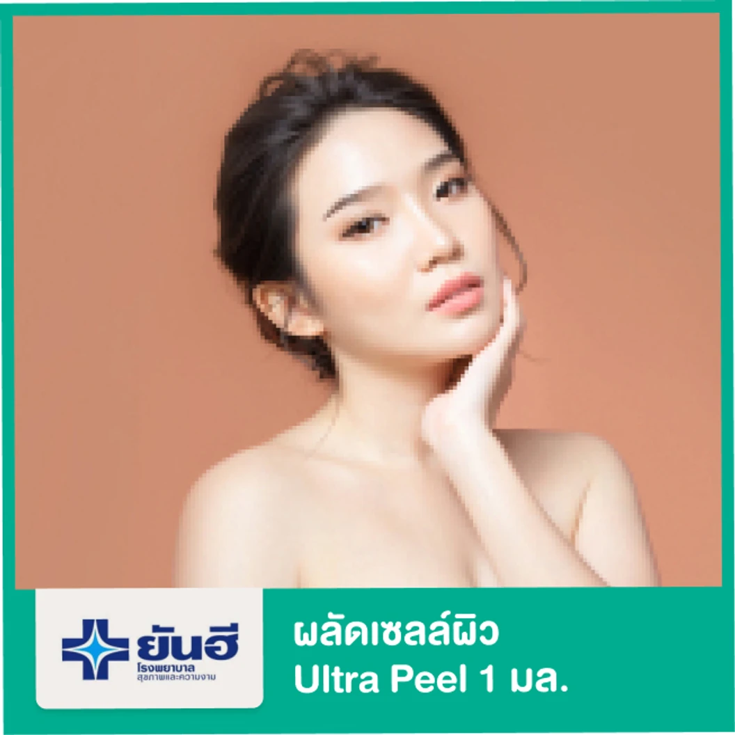 ผลัดเซลล์ผิว ด้วย Ultra Peel 1 มล.